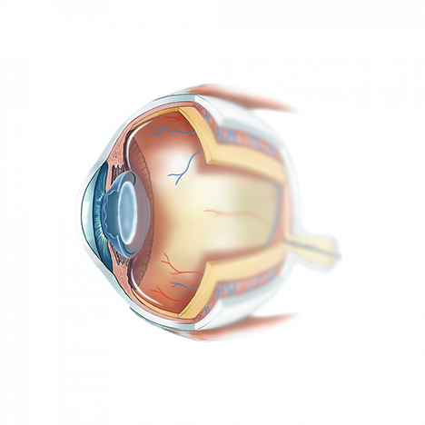 Implant intra-oculaire