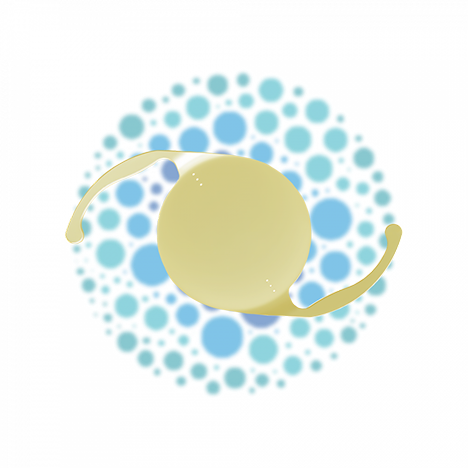 Illustration de la sélection d'implants