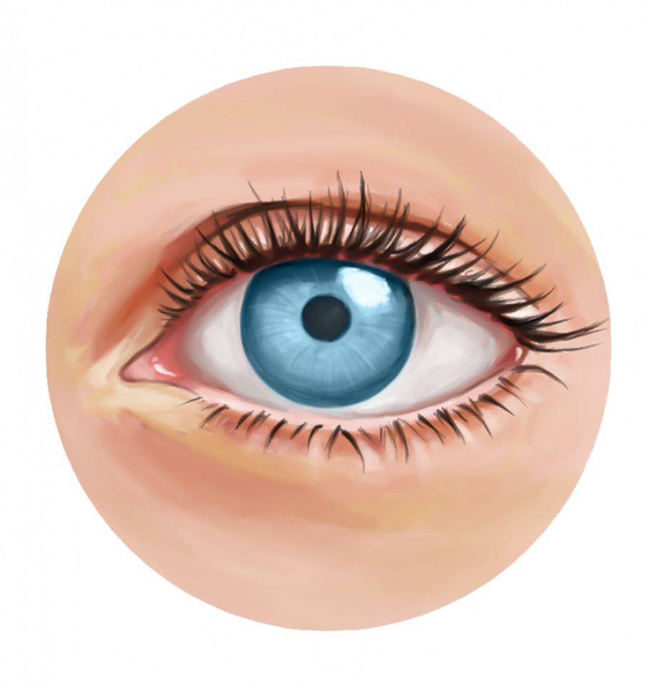 Illustration de la sélection d'implants